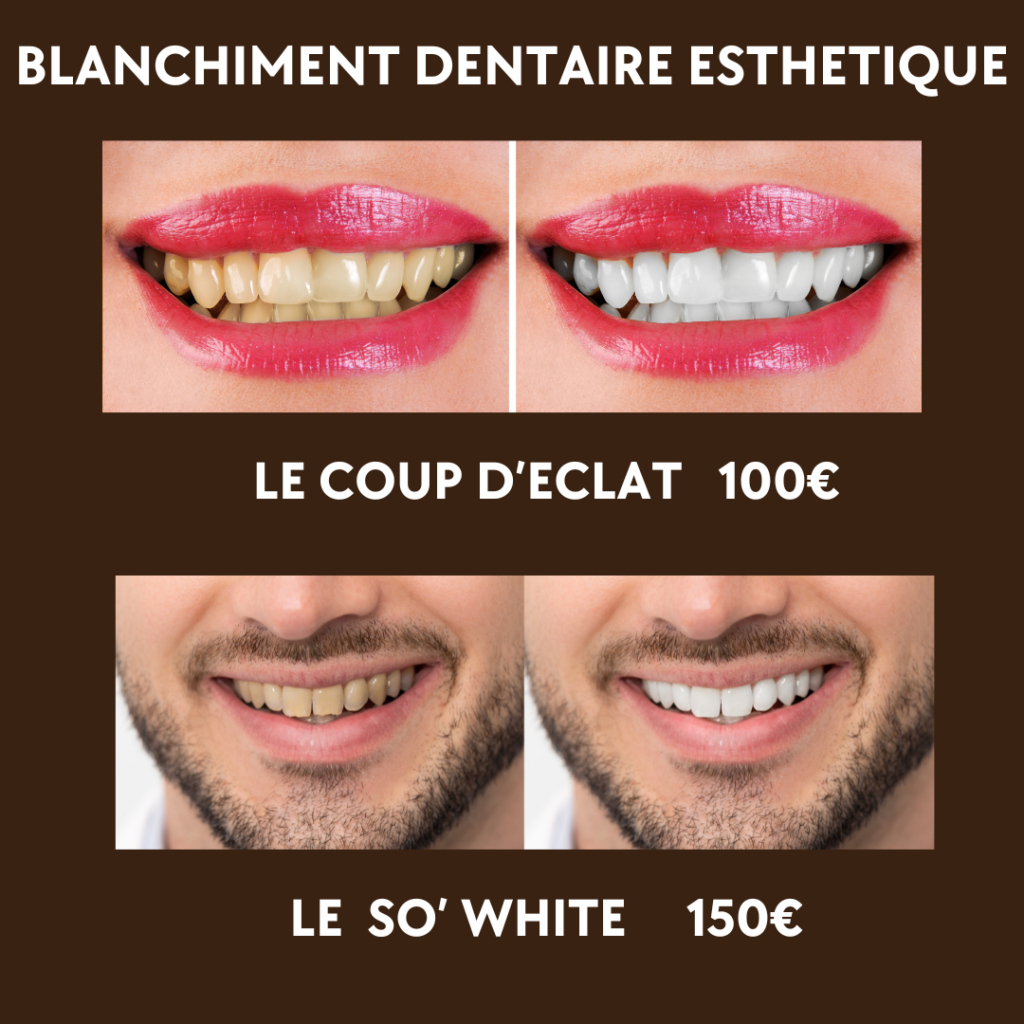 Blanchiment dentaire Américain